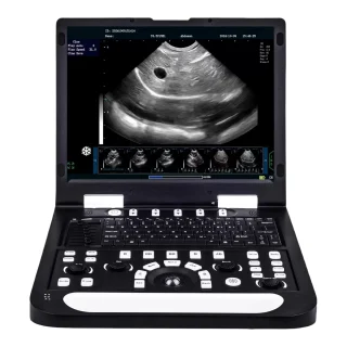 Ecógrafo Veterinario N60 Basado en PC | Pantalla 15″ y PW Actualizable para Clínicas